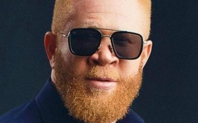 Nollywood Actor Reveals Challenges in Pursuing Acting Dreams Despite Albinism